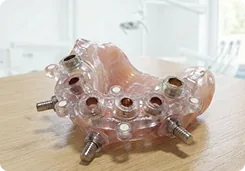 Mucosa-supported Surgical Guides